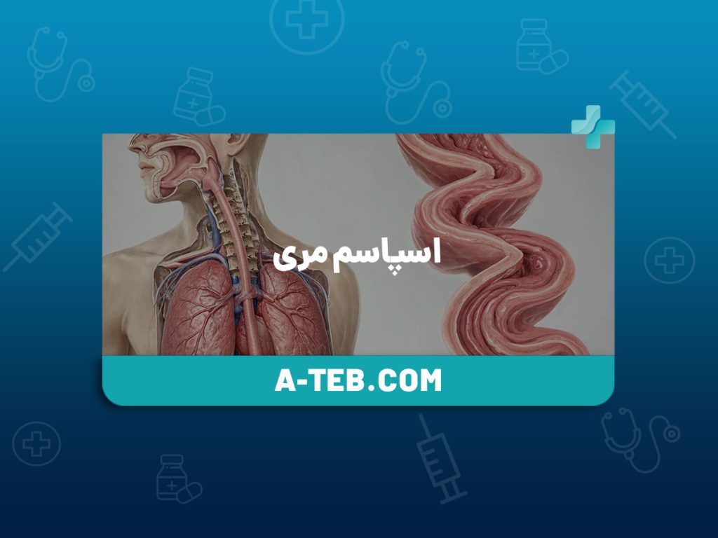 اسپاسم مری