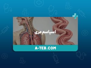 اسپاسم مری