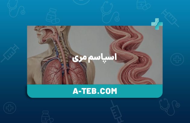 اسپاسم مری