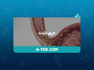 مری بارت