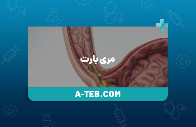 مری بارت