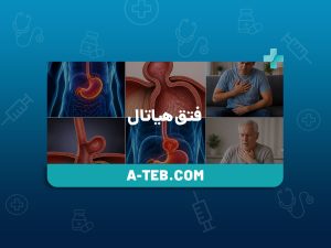 فتق هیاتال