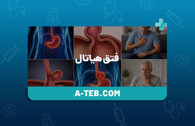 فتق هیاتال