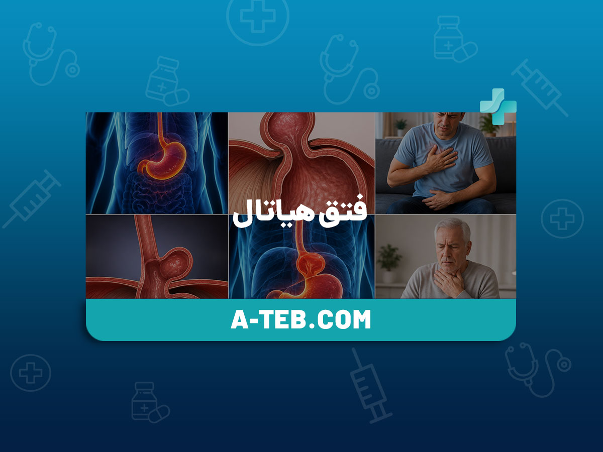 فتق هیاتال
