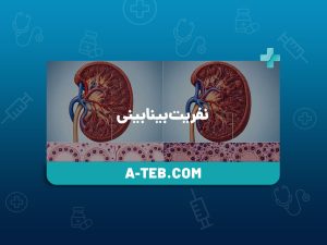 نفریت بینابینی