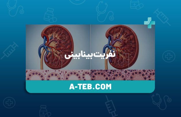 نفریت بینابینی
