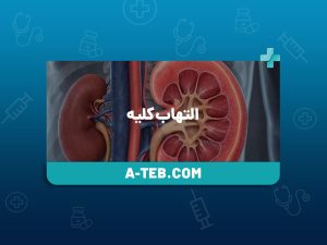 التهاب کلیه