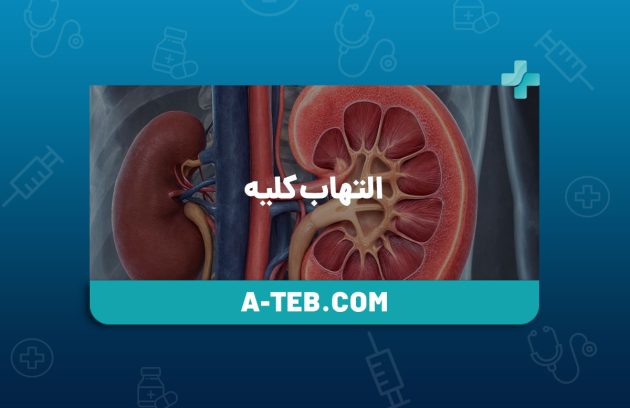 التهاب کلیه
