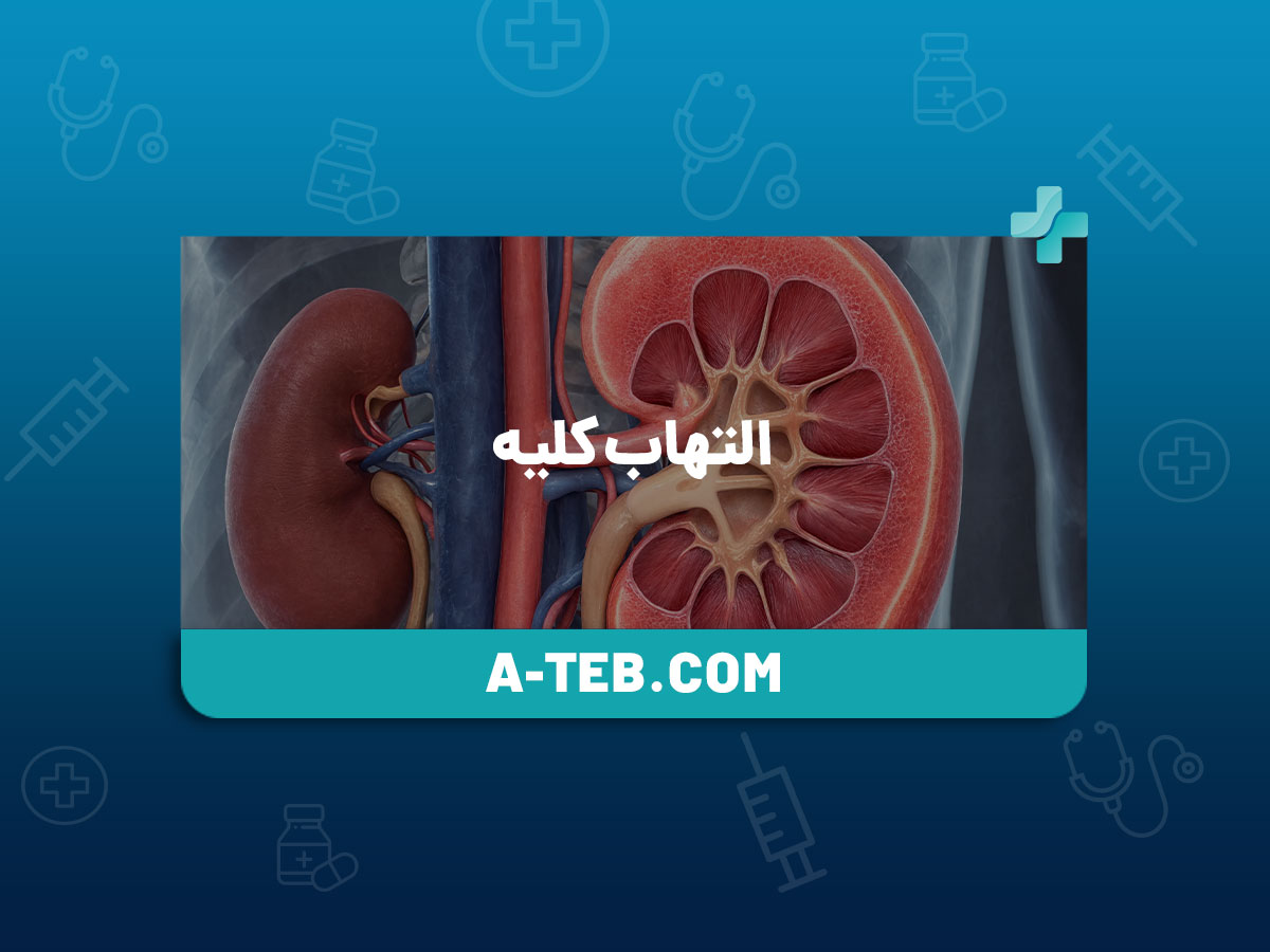 التهاب کلیه