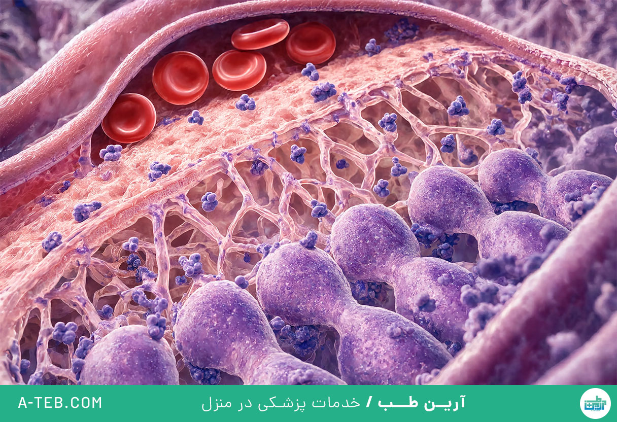 نفروپاتی دیابتی