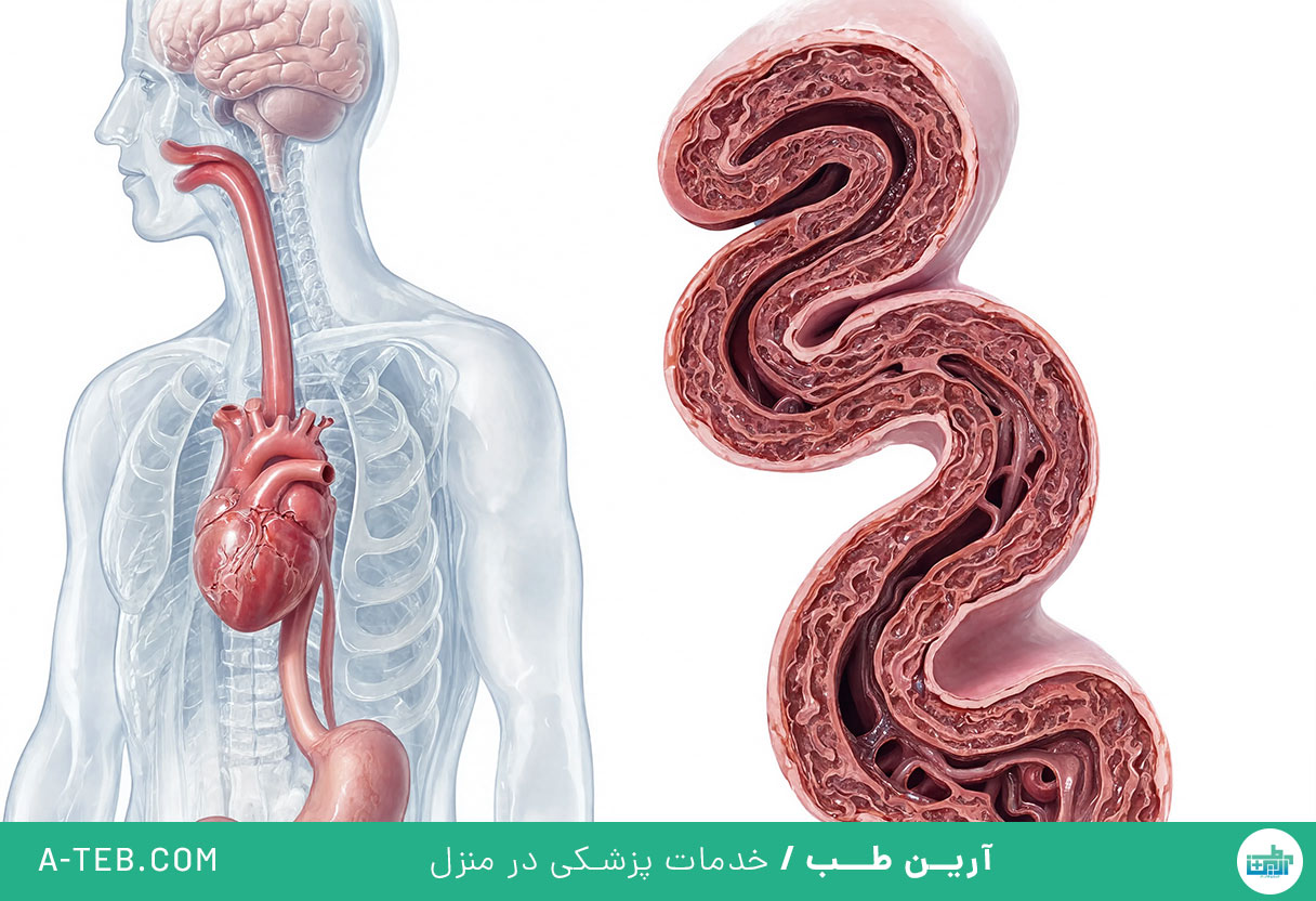 اسپاسم مری