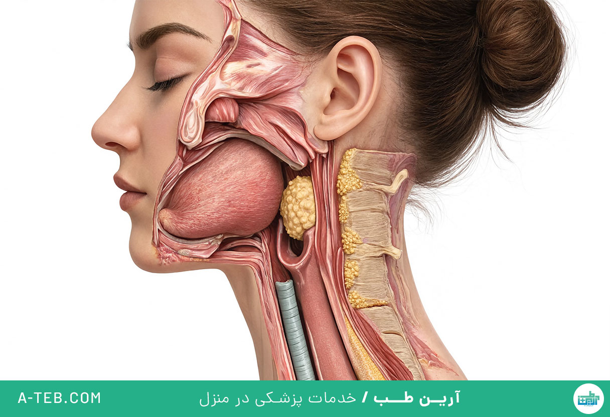 اختلال بلع