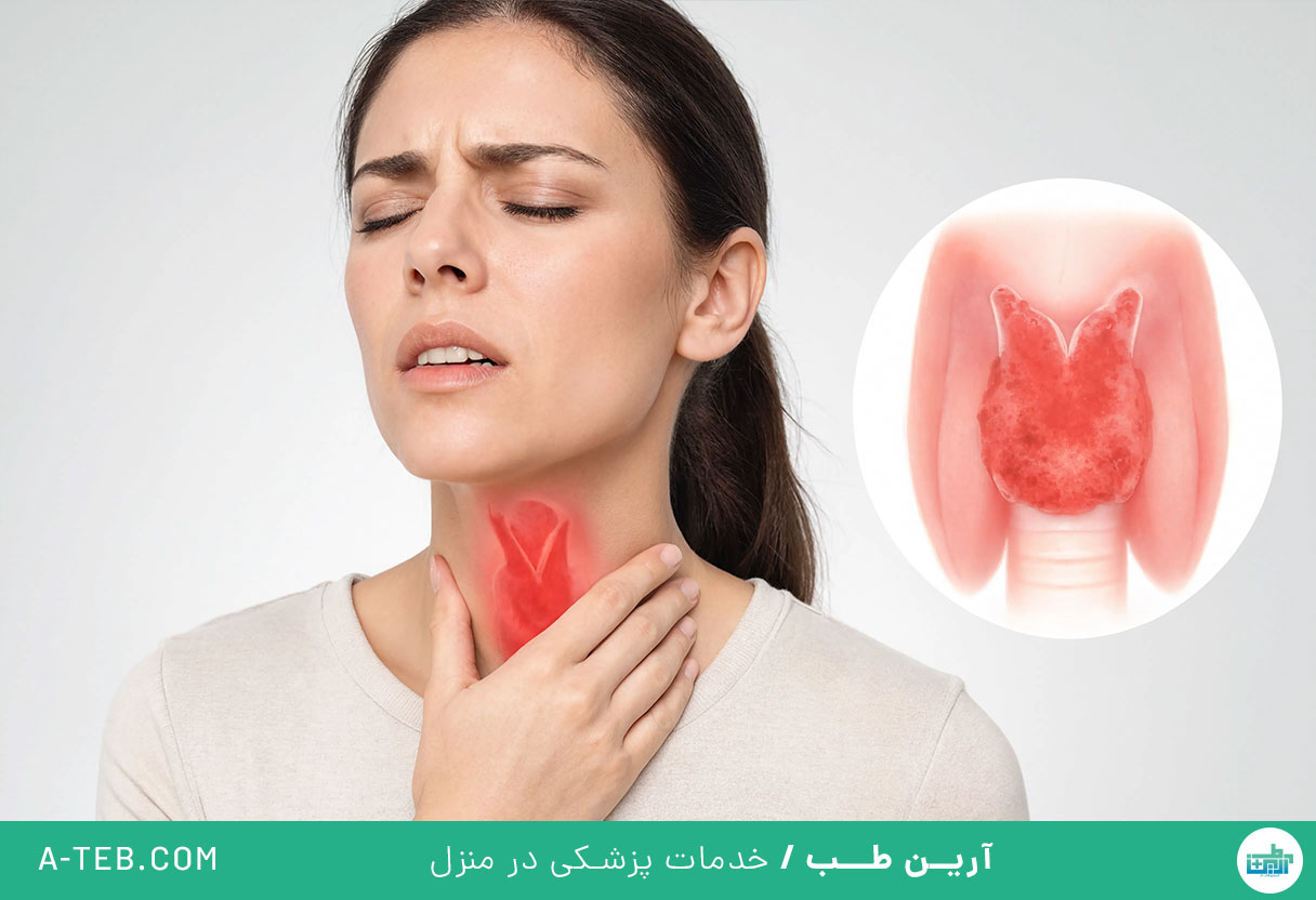 گلو درد حاد