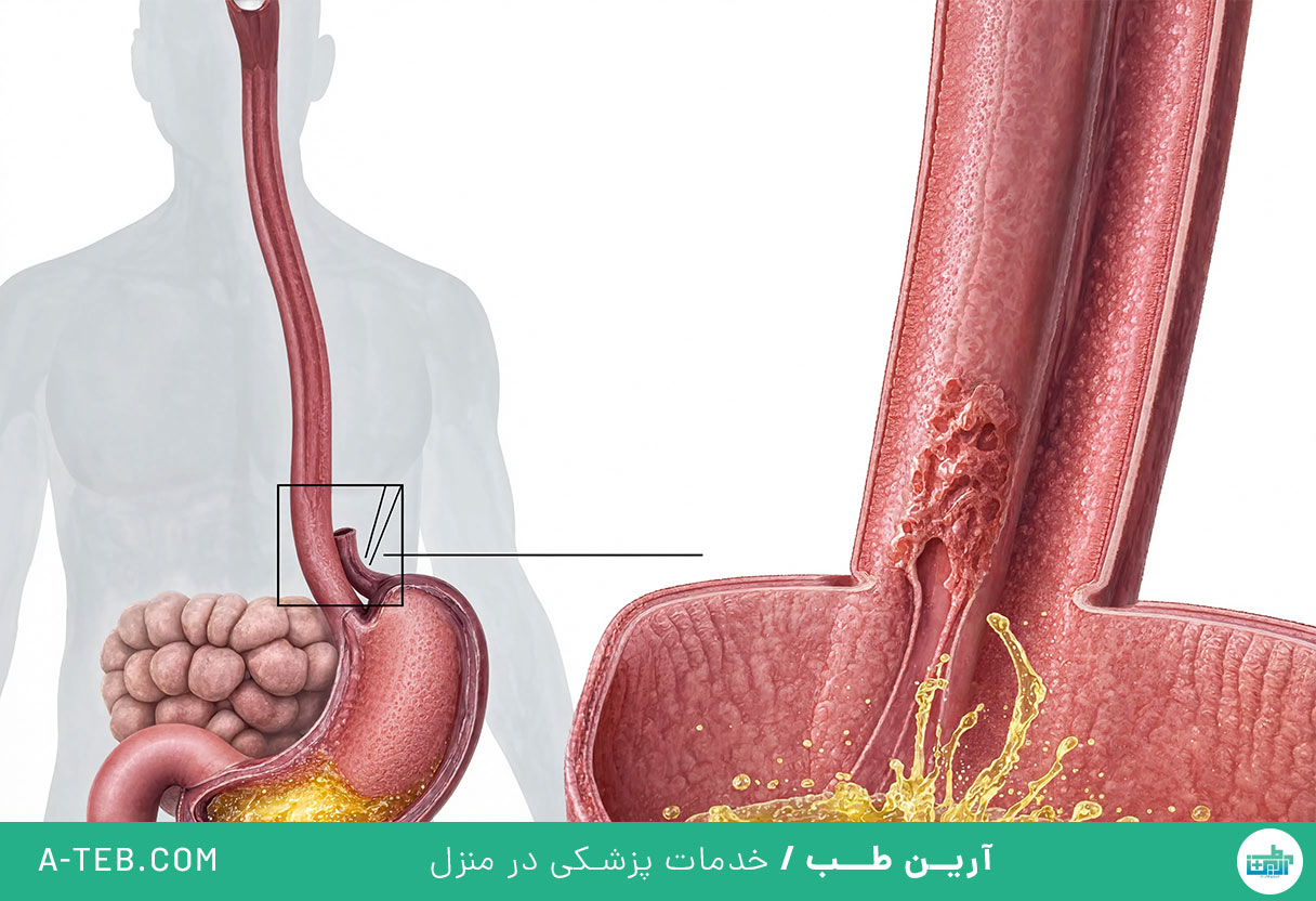 مری بارت
