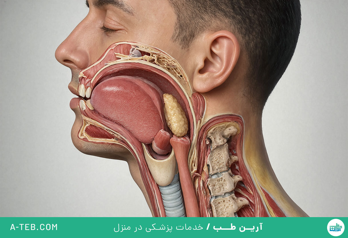 اختلال بلع