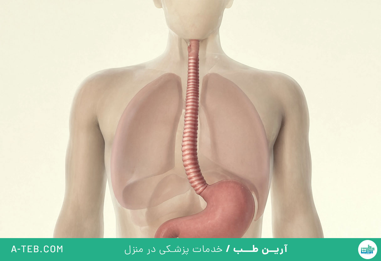 اسپاسم مری