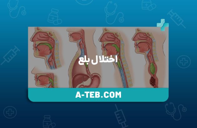 اختلال بلع