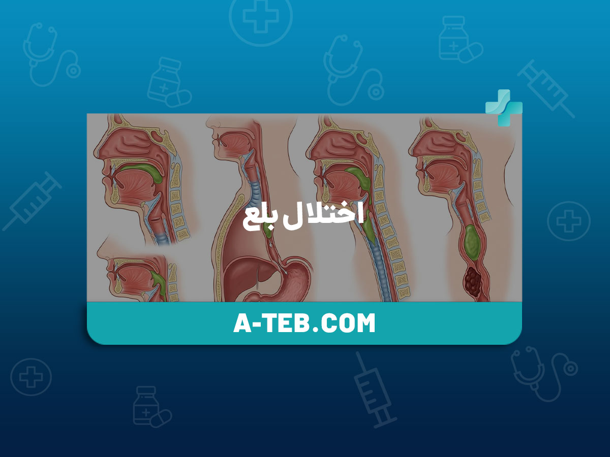 اختلال بلع
