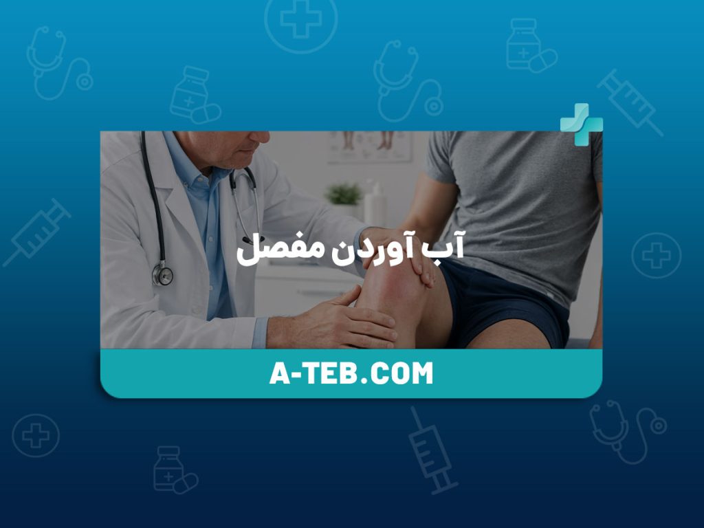 آب آوردن مفصل