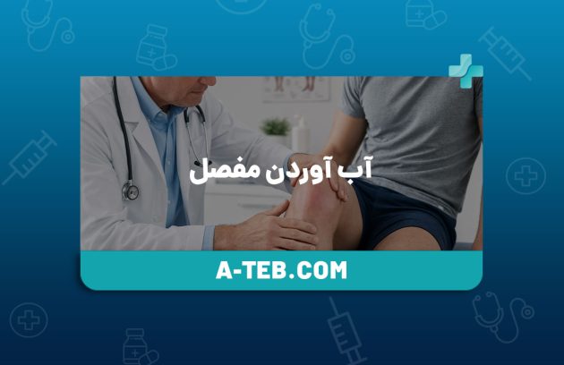 آب آوردن مفصل