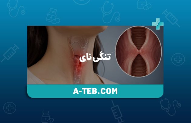 تنگی نای