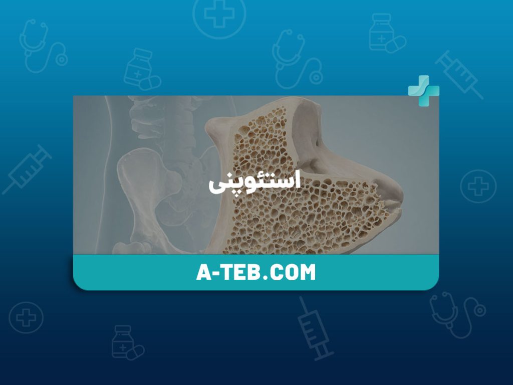 استئوپنی