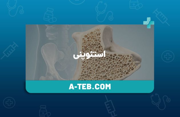 استئوپنی