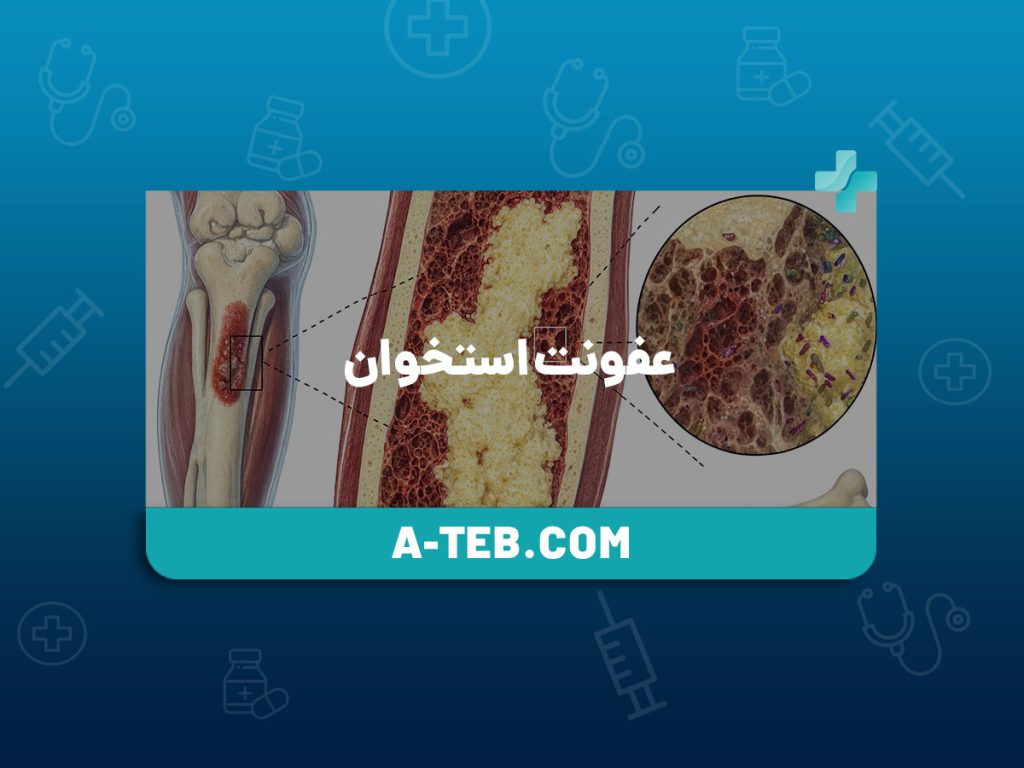 عفونت استخوان