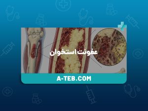 عفونت استخوان