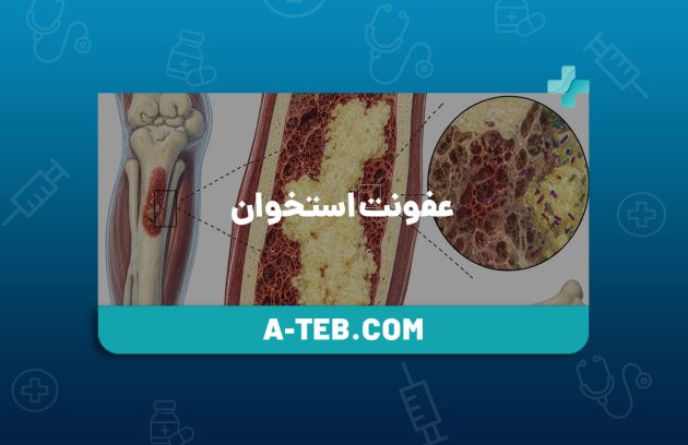 عفونت استخوان