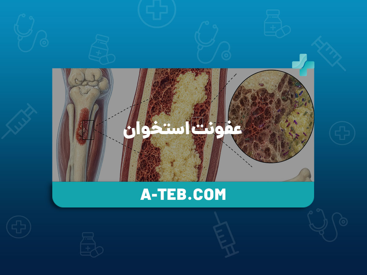 عفونت استخوان