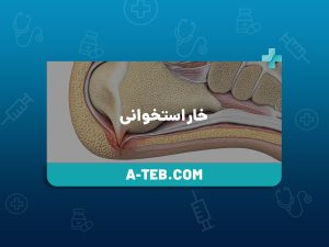 خار استخوانی