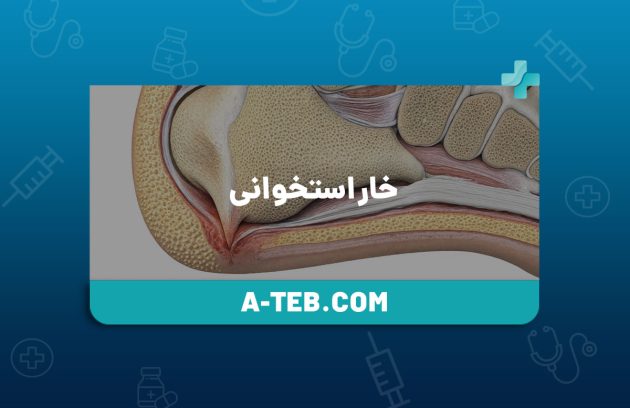 خار استخوانی