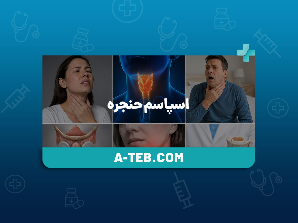 اسپاسم حنجره