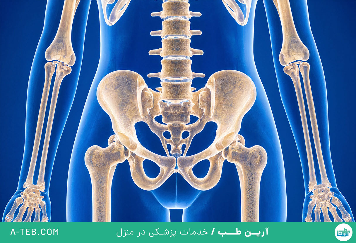 استئوپنی