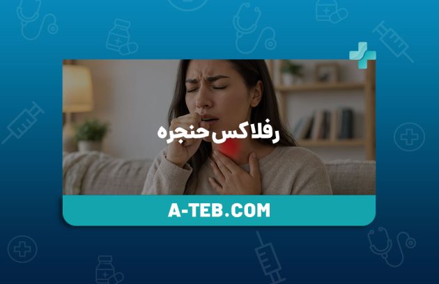 رفلاکس حنجره