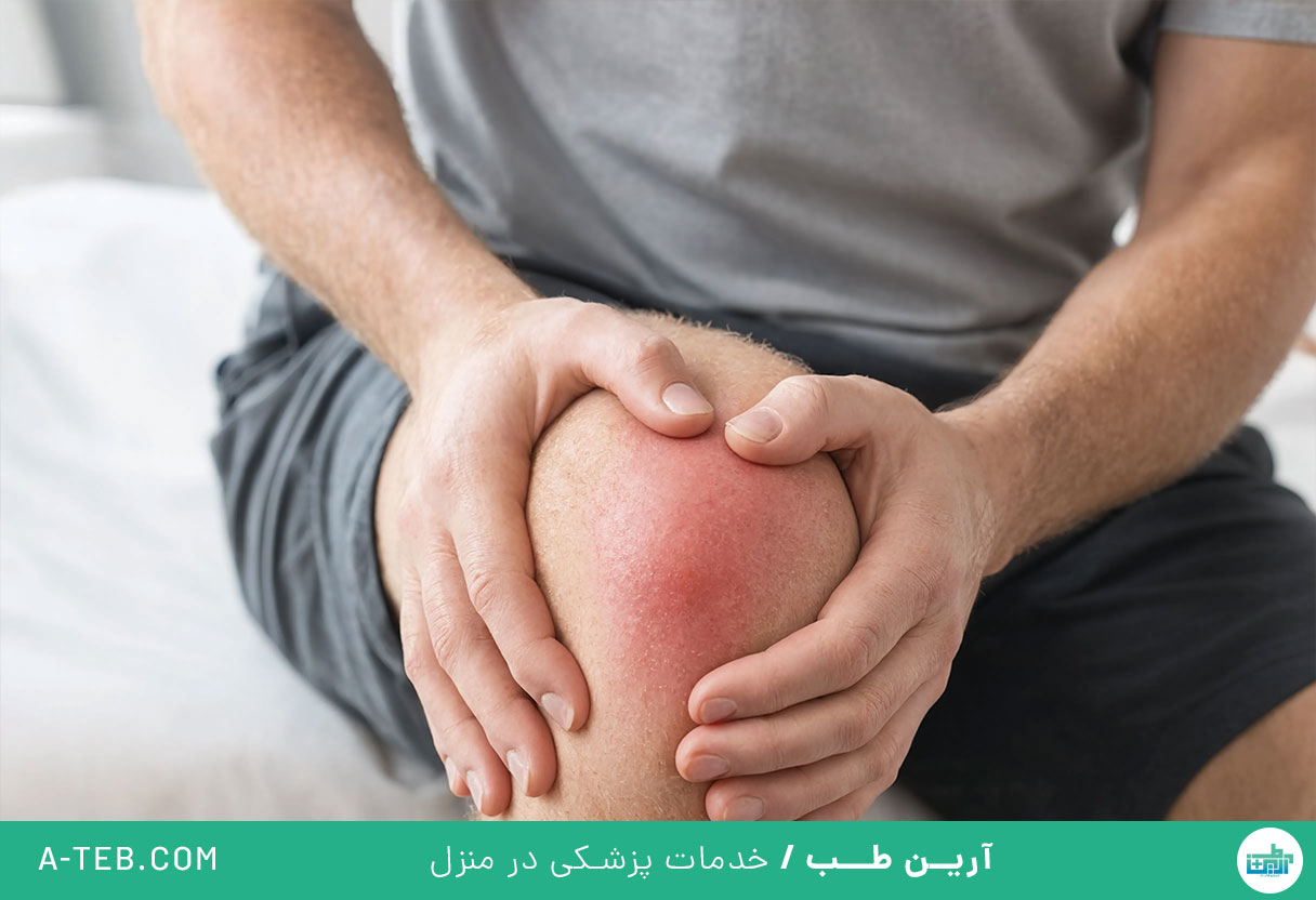 التهاب مفصل