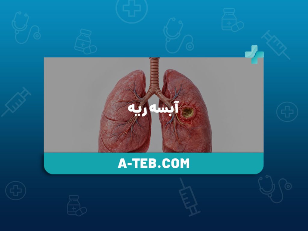 آبسه ریه