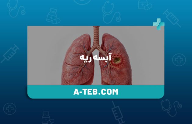 آبسه ریه