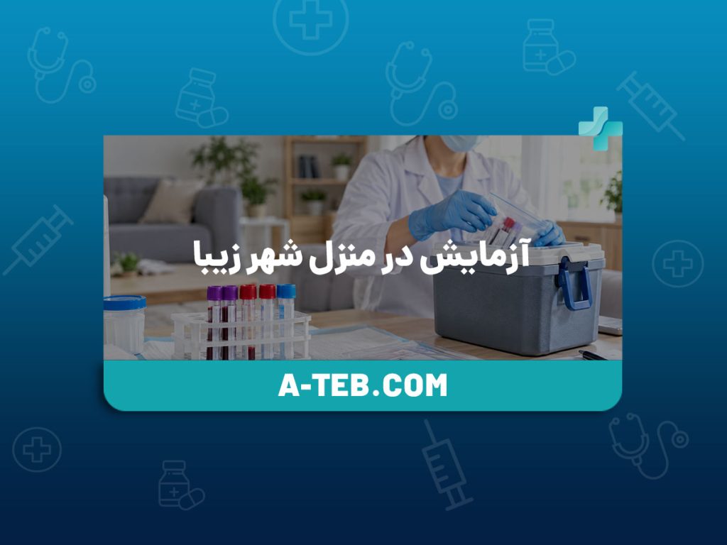 آزمایش در منزل شهر زیبا