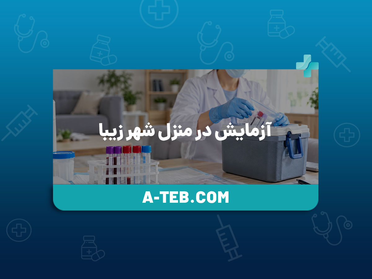 آزمایش در منزل شهر زیبا