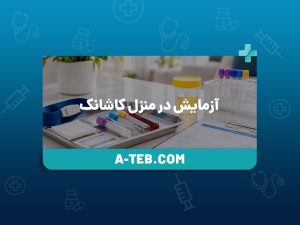 آزمایش در منزل کاشانک