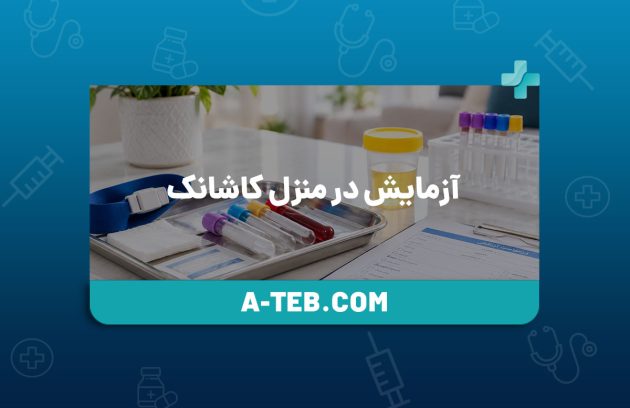 آزمایش در منزل کاشانک