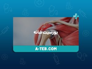 بورسیت شانه