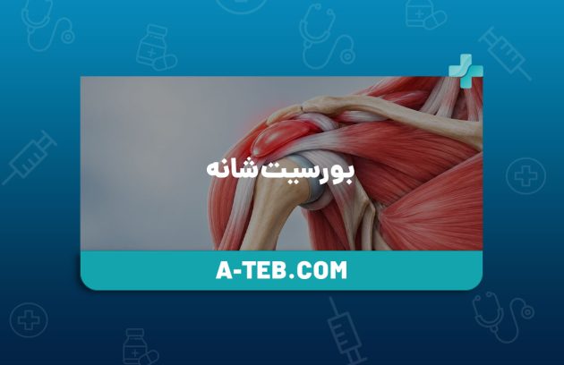 بورسیت شانه