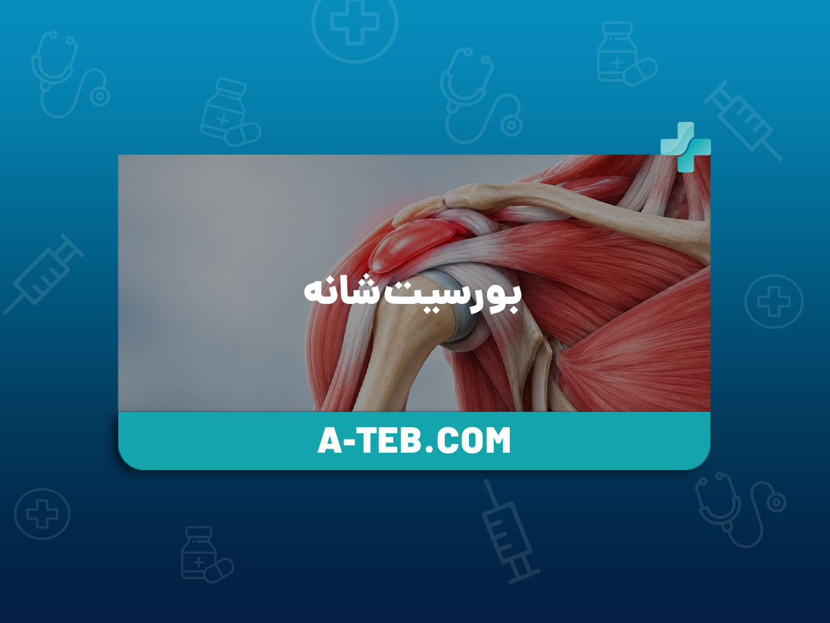 بورسیت شانه