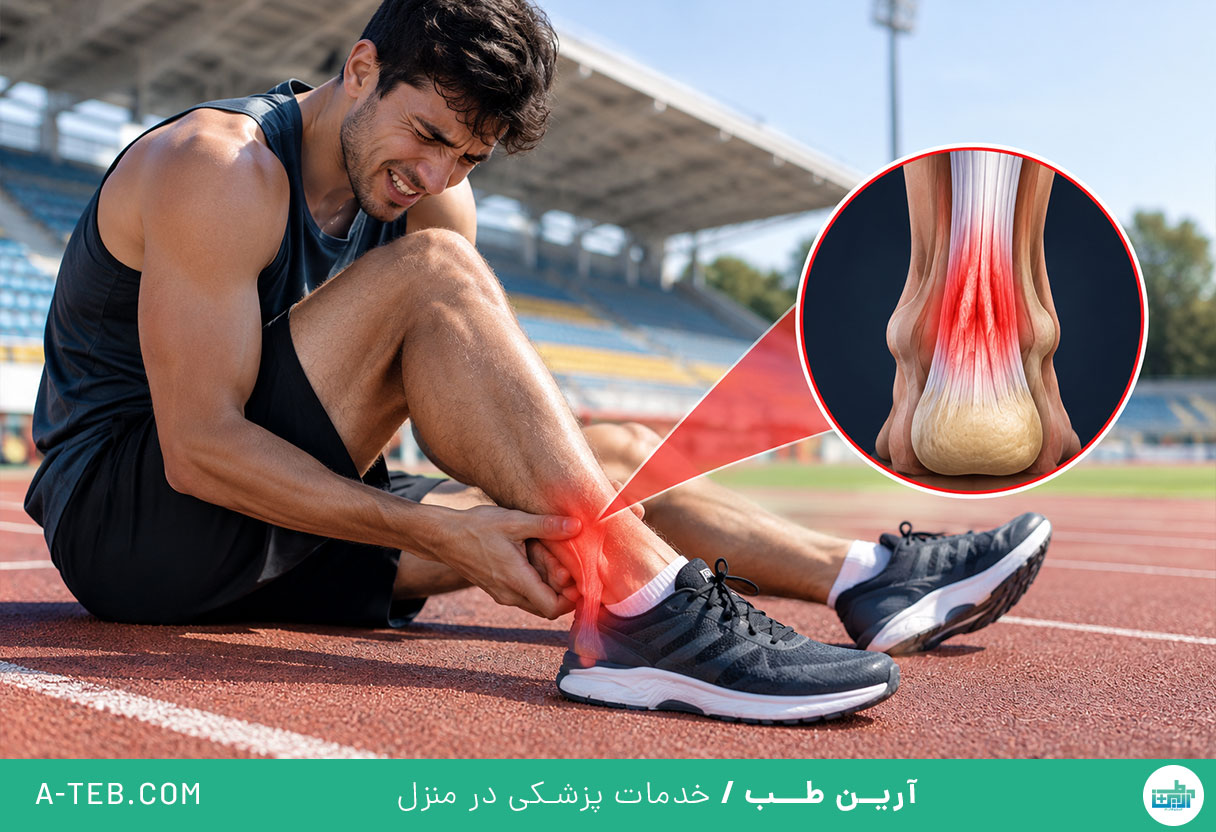 تاندونیت آشیل