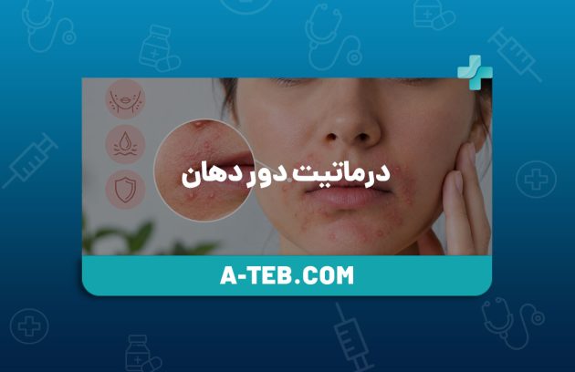 درماتیت دور دهان