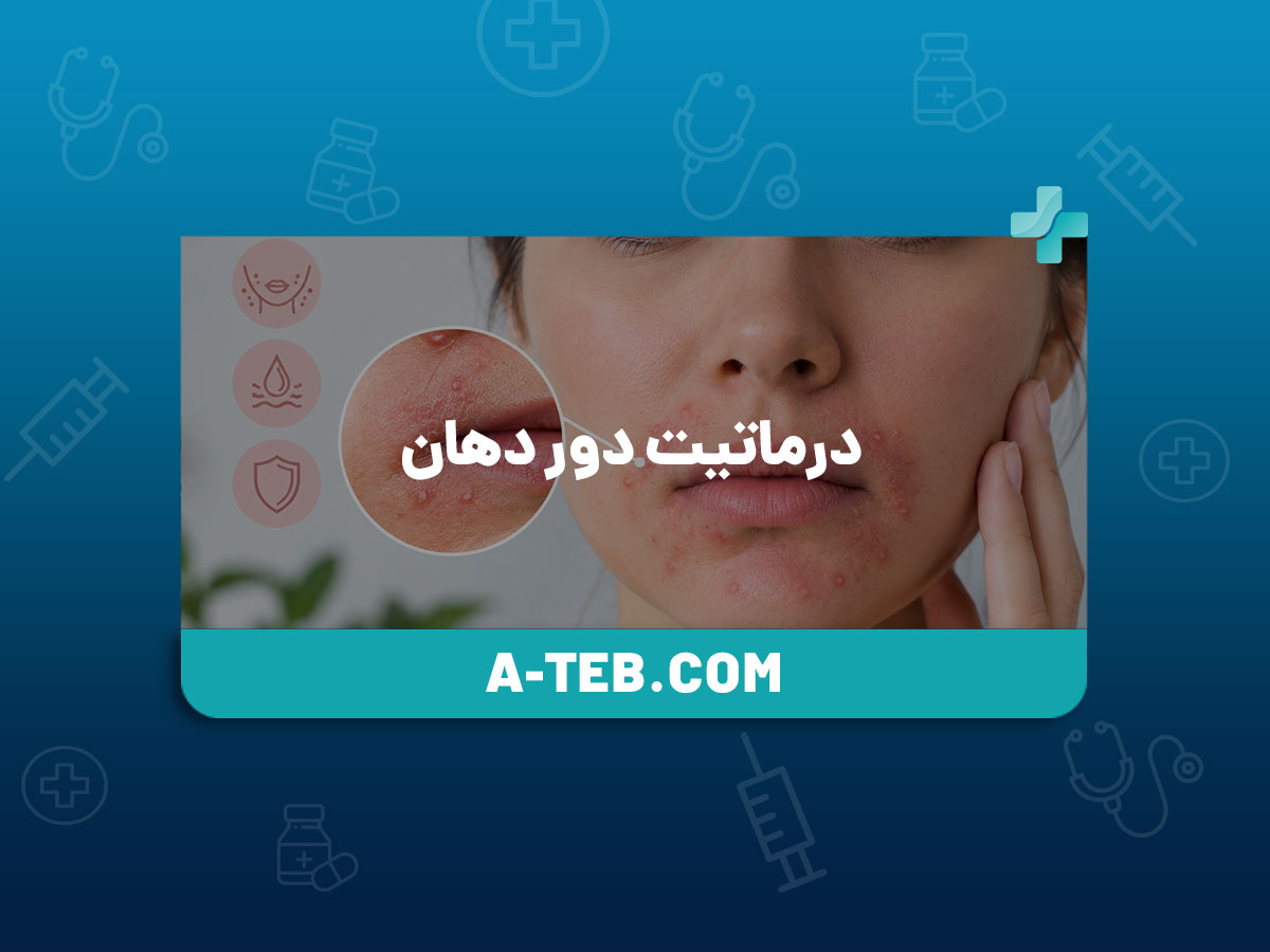 درماتیت دور دهان
