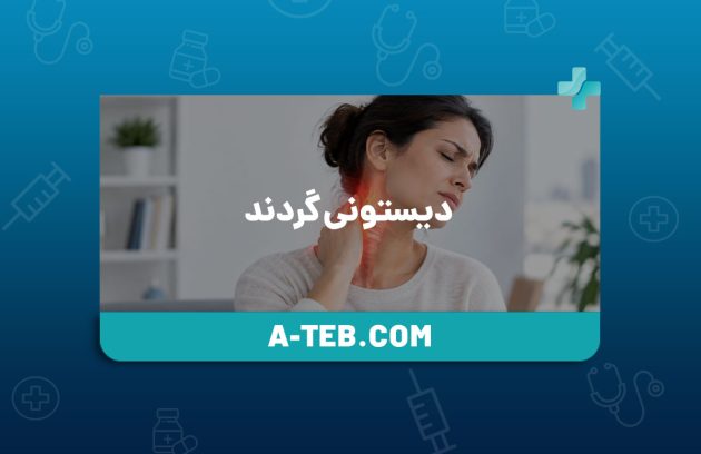 دیستونی گردن